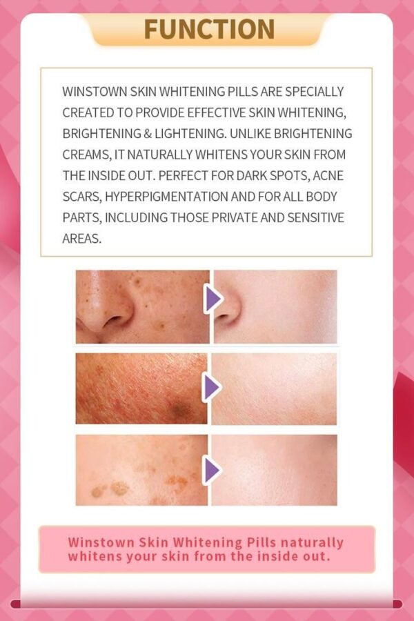 SKIN WHITENING & DARK SPOTS TREATMENT 600mg x 60tablets - Image 6